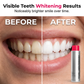 🥳 2026 HOT SALE 🥳💞 50K+ VERKOCHT! 😁✨ 50% RABATT! Vlekverwijderende whitening mondspoeling – verwijdert koffie- en theevlekken, alcoholvrij. Bindt vuil direct, zorgt voor langdurig frisse adem met muntsmaak. Zacht genoeg voor dagelijks gebruik. 🦷💙